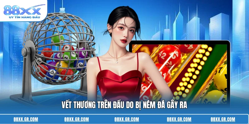 Vết thương trên đầu do bị ném đá gây ra